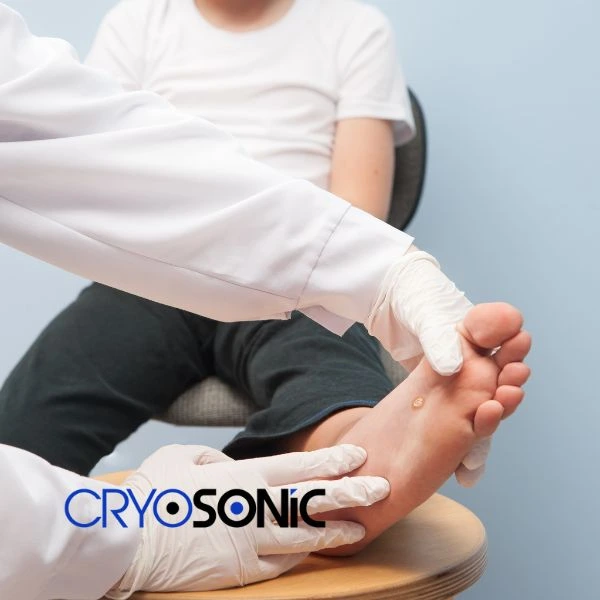 Are you looking for fast effective wart removal Contact us today Crewe