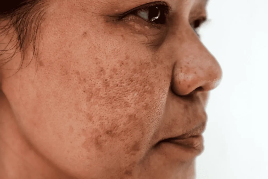 Cryosonic Repair Sun-Damaged Skin Crewe Crewe