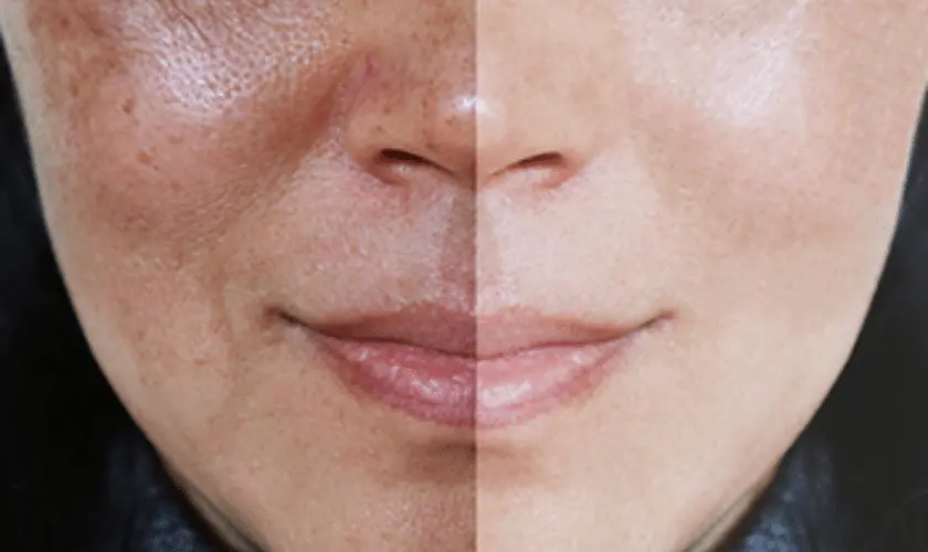 What Lifestyle Changes Support Skin Repair Crewe? Crewe